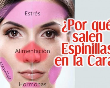 Por qué salen espinillas en la cara