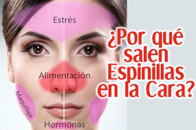 Espinillas Como Eliminarlas De Nariz y Cara