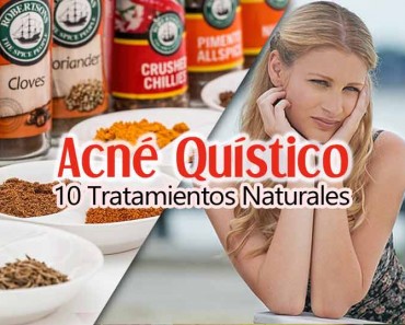 Acné Quístico: 10 Tratamientos Naturales Que Funcionan