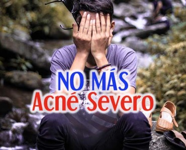 Acne-Severo