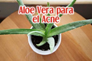 Aloe Vera para el acné