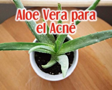 Aloe Vera Para El Acné: 17 Formas De Usarlo