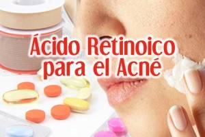 acido retionico para el acne