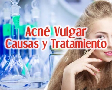 Acne Vulgar: Causas, Síntomas y Tratamiento