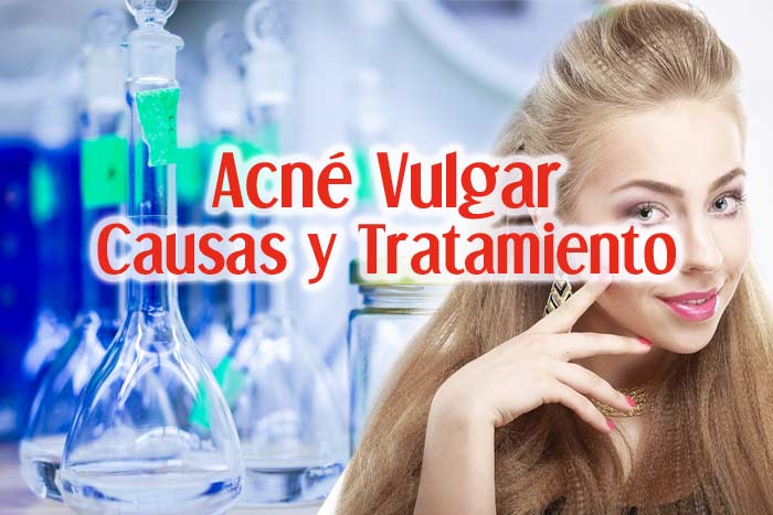 Acne Vulgar: Causas, Síntomas y Tratamiento