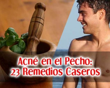 Acné en el Pecho: Remedios Caseros para las Espinillas en el Pecho