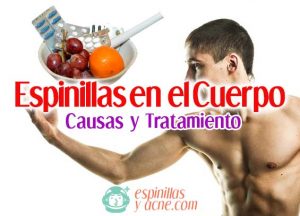 Espinillas en el cuerpo