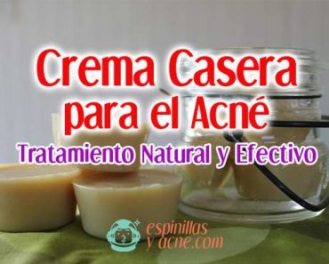 Crema Para Las Espinillas Casera