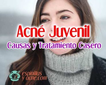 Acné Juvenil: Causas y Tratamiento