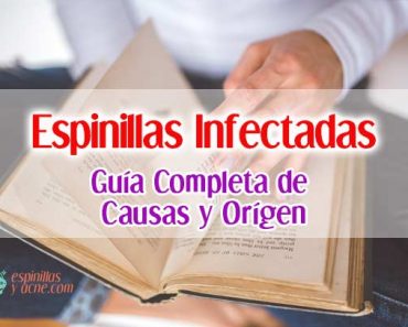 Espinillas Infectadas: Causas, Síntomas y Solución