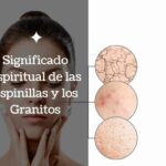 Significado espiritual de las espinillas y los granitos.jpg