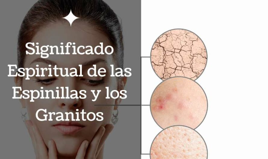 El significado espiritual de las espinillas y los granitos del acné: Cómo interpretarlos según su ubicación en el rostro